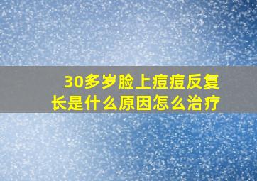 30多岁脸上痘痘反复长是什么原因怎么治疗