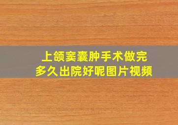 上颌窦囊肿手术做完多久出院好呢图片视频