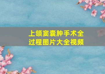 上颌窦囊肿手术全过程图片大全视频