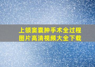 上颌窦囊肿手术全过程图片高清视频大全下载