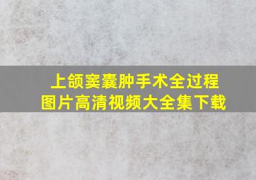 上颌窦囊肿手术全过程图片高清视频大全集下载