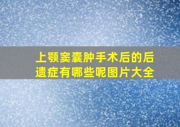 上颚窦囊肿手术后的后遗症有哪些呢图片大全