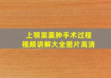 上颚窦囊肿手术过程视频讲解大全图片高清