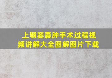 上颚窦囊肿手术过程视频讲解大全图解图片下载