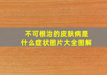 不可根治的皮肤病是什么症状图片大全图解