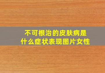 不可根治的皮肤病是什么症状表现图片女性