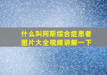 什么叫阿斯综合症患者图片大全视频讲解一下