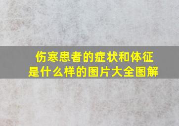 伤寒患者的症状和体征是什么样的图片大全图解