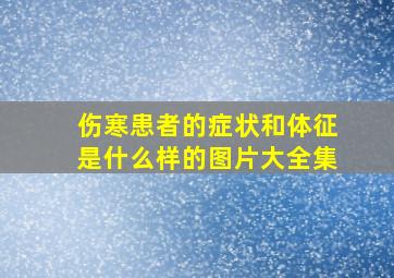 伤寒患者的症状和体征是什么样的图片大全集