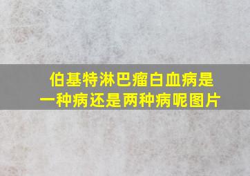 伯基特淋巴瘤白血病是一种病还是两种病呢图片