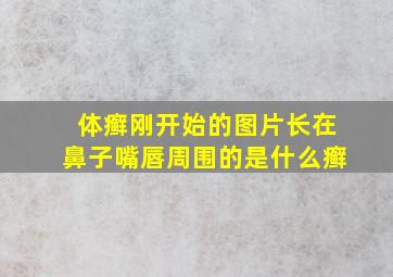 体癣刚开始的图片长在鼻子嘴唇周围的是什么癣