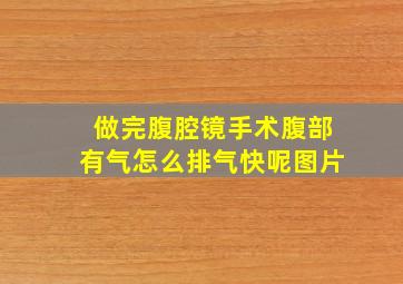 做完腹腔镜手术腹部有气怎么排气快呢图片