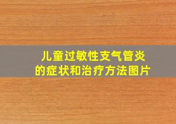 儿童过敏性支气管炎的症状和治疗方法图片