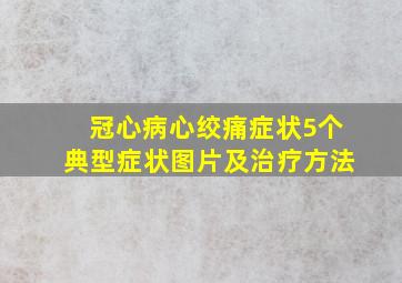 冠心病心绞痛症状5个典型症状图片及治疗方法