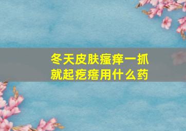 冬天皮肤瘙痒一抓就起疙瘩用什么药