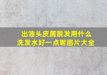 出油头皮屑脱发用什么洗发水好一点呢图片大全