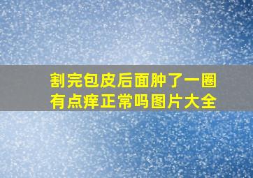 割完包皮后面肿了一圈有点痒正常吗图片大全