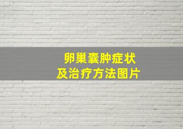 卵巢囊肿症状及治疗方法图片