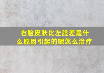 右脸皮肤比左脸差是什么原因引起的呢怎么治疗