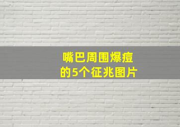 嘴巴周围爆痘的5个征兆图片