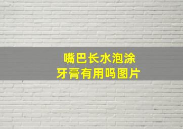 嘴巴长水泡涂牙膏有用吗图片