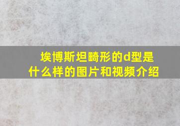 埃博斯坦畸形的d型是什么样的图片和视频介绍