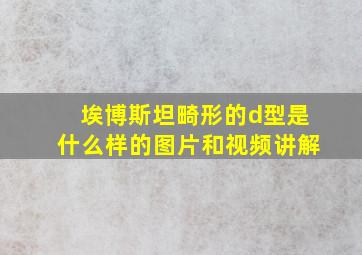 埃博斯坦畸形的d型是什么样的图片和视频讲解