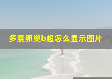 多囊卵巢b超怎么显示图片