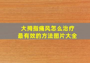 大拇指痛风怎么治疗最有效的方法图片大全