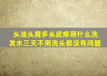 头油头屑多头皮痒用什么洗发水三天不用洗头都没有问题