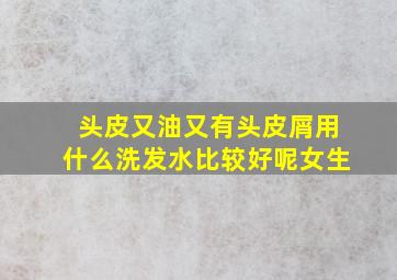 头皮又油又有头皮屑用什么洗发水比较好呢女生