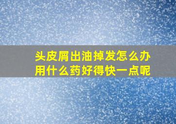 头皮屑出油掉发怎么办用什么药好得快一点呢