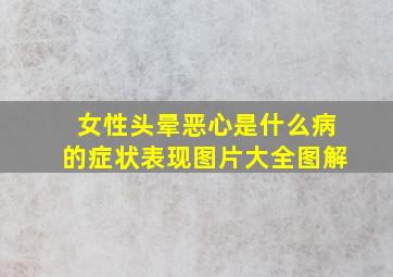 女性头晕恶心是什么病的症状表现图片大全图解