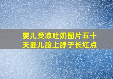 婴儿受凉吐奶图片五十天婴儿脸上脖子长红点