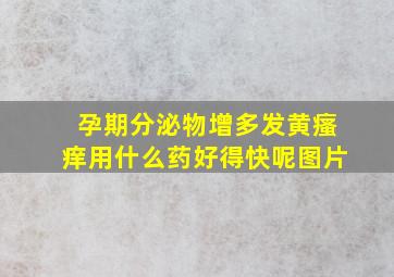 孕期分泌物增多发黄瘙痒用什么药好得快呢图片