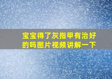 宝宝得了灰指甲有治好的吗图片视频讲解一下