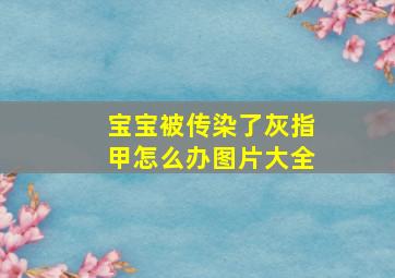 宝宝被传染了灰指甲怎么办图片大全