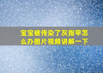 宝宝被传染了灰指甲怎么办图片视频讲解一下