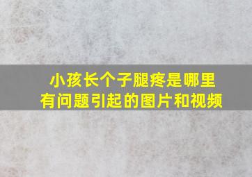 小孩长个子腿疼是哪里有问题引起的图片和视频