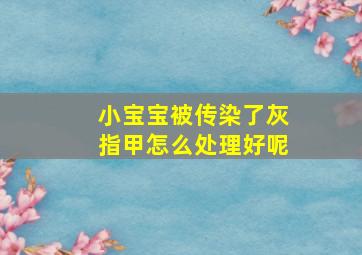 小宝宝被传染了灰指甲怎么处理好呢