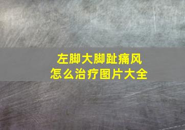 左脚大脚趾痛风怎么治疗图片大全