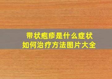 带状疱疹是什么症状如何治疗方法图片大全