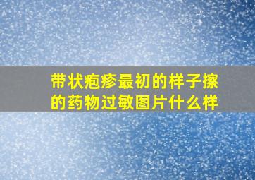 带状疱疹最初的样子擦的药物过敏图片什么样