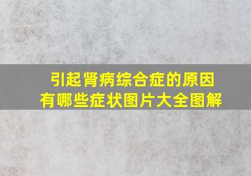 引起肾病综合症的原因有哪些症状图片大全图解