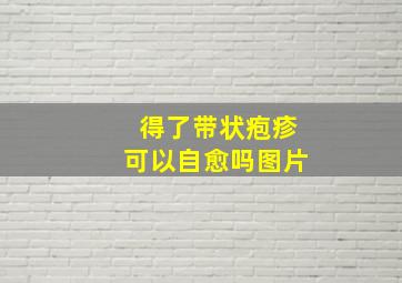 得了带状疱疹可以自愈吗图片