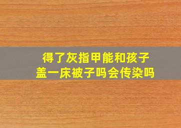 得了灰指甲能和孩子盖一床被子吗会传染吗