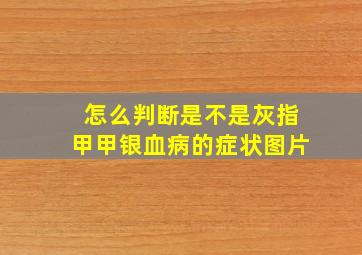 怎么判断是不是灰指甲甲银血病的症状图片