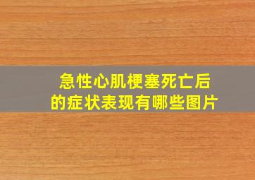 急性心肌梗塞死亡后的症状表现有哪些图片