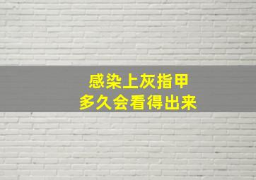 感染上灰指甲多久会看得出来