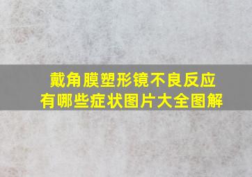 戴角膜塑形镜不良反应有哪些症状图片大全图解